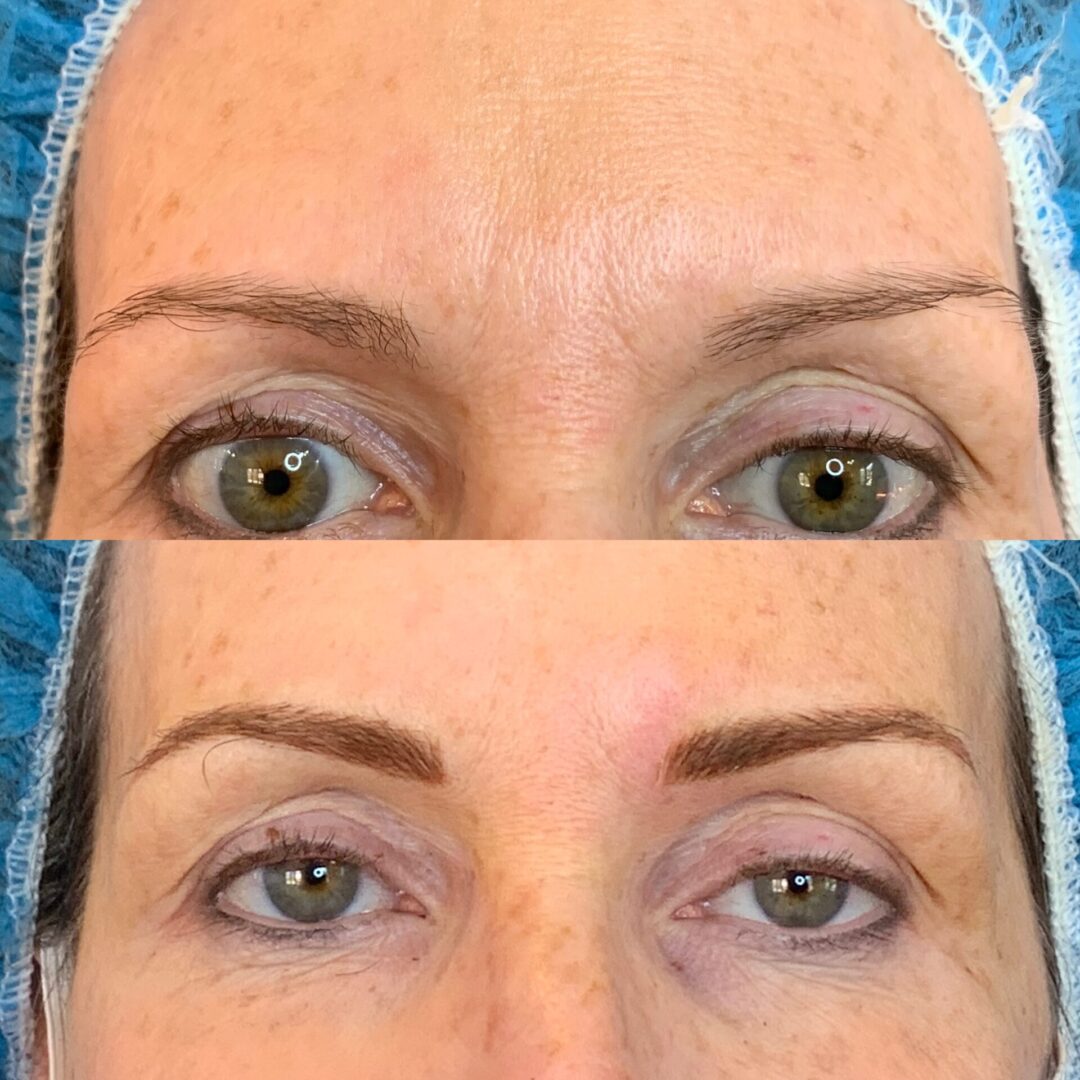 A before and after picture of the brows of a woman.