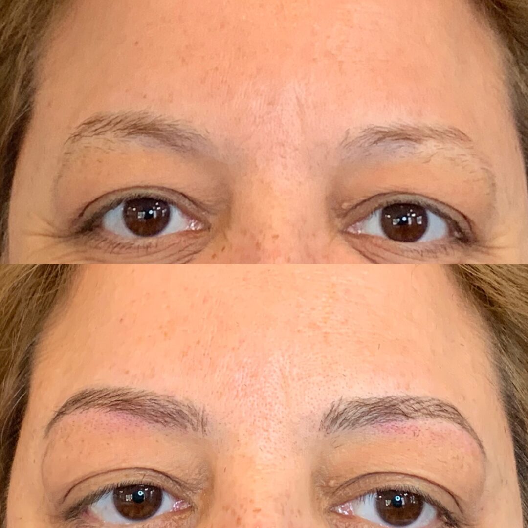 A before and after picture of the brows of a woman.