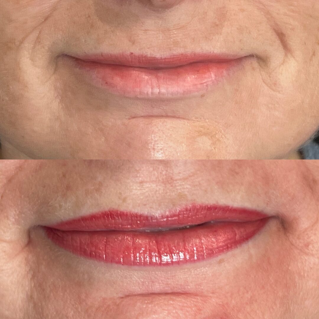 A before and after picture of the lips