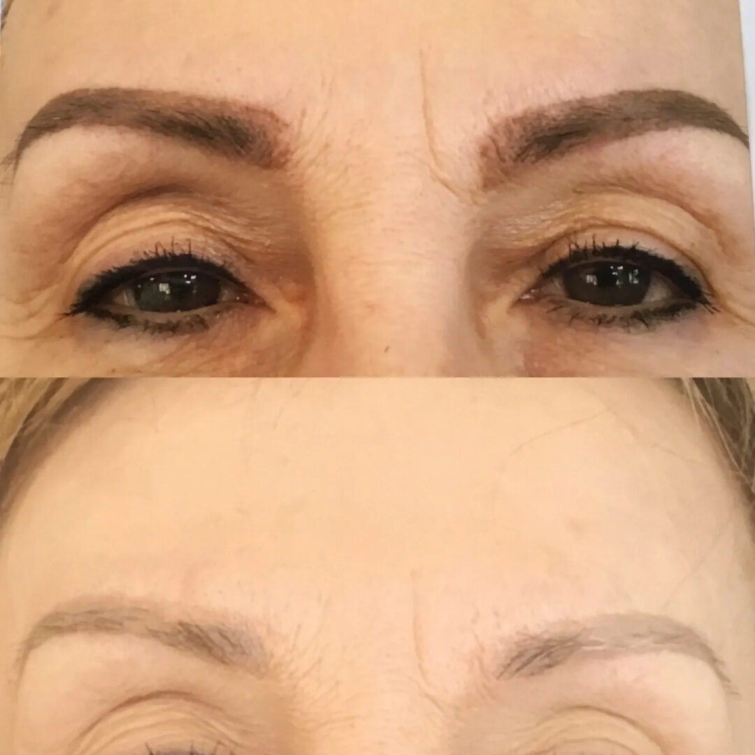 A woman with brown eyes and brows before and after